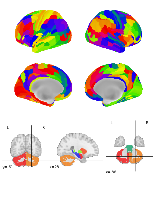 ../_images/plot_cifti_from_rois_plot_cifti_from_rois_10_0.png