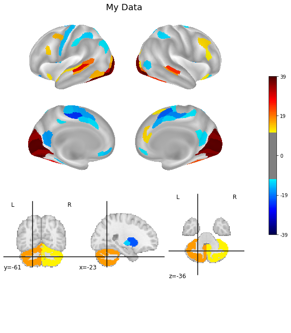 ../_images/plot_cifti_from_rois_plot_cifti_from_rois_9_1.png